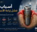 رسم توضيحي يشرح أسباب فشل زراعة الأسنان باستخدام زرعة IMPLA الألمانية مع أبرز العلامات المبكرة وطرق الوقاية للحفاظ على نجاح الزراعة.