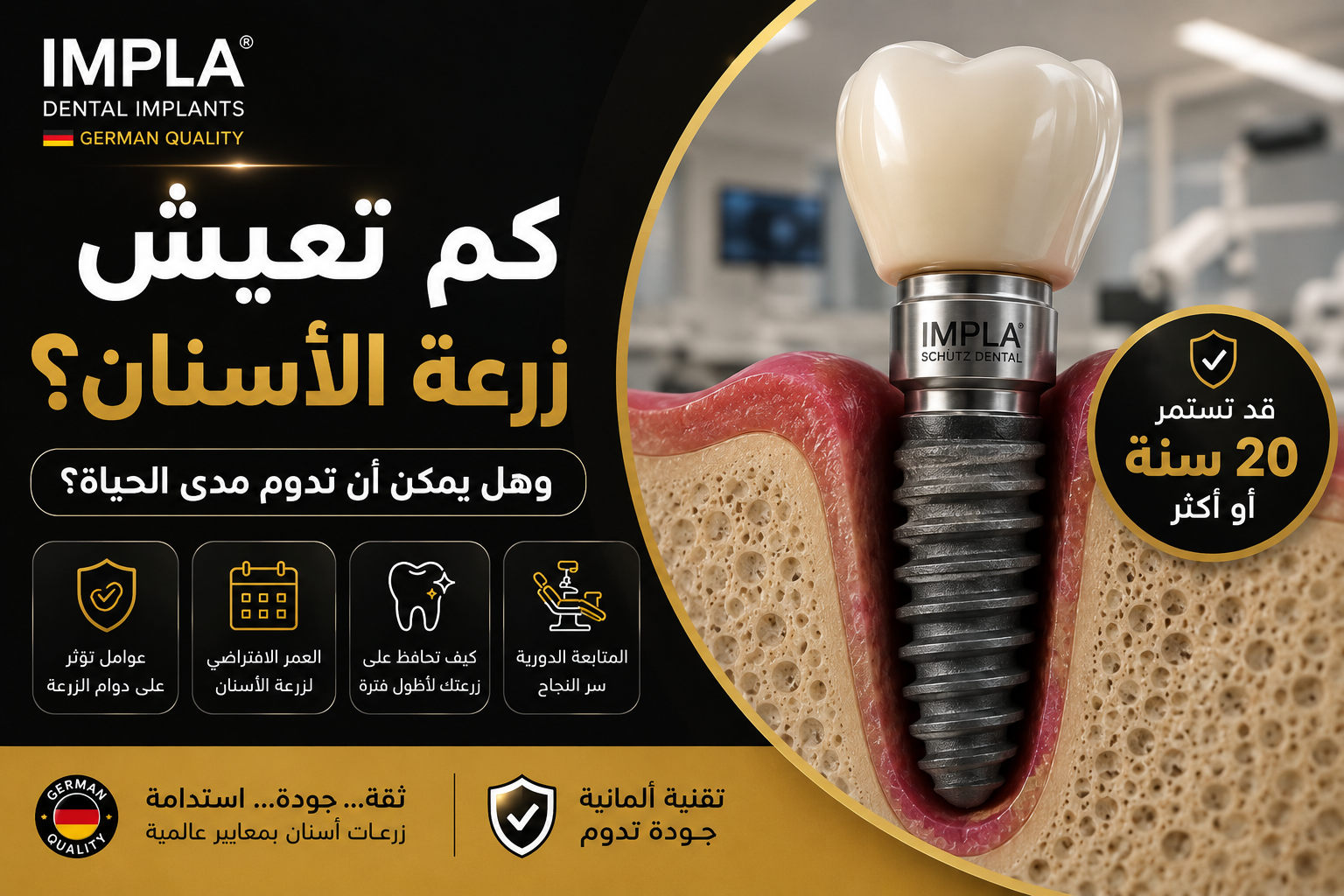 زرعة أسنان IMPLA الألمانية توضح العمر الافتراضي لزراعة الأسنان وإمكانية استمرارها لأكثر من 20 سنة مع العناية المناسبة.