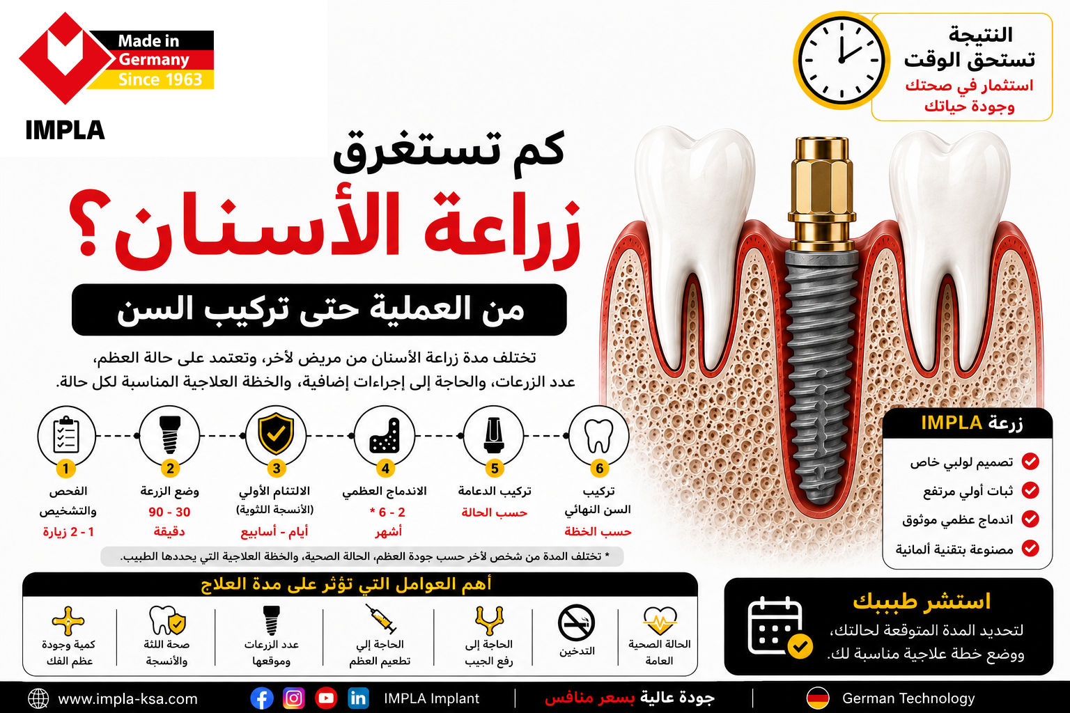 كم تستغرق زراعة الأسنان من وضع الزرعة حتى تركيب السن النهائي مع توضيح مراحل العلاج باستخدام زرعة IMPLA.