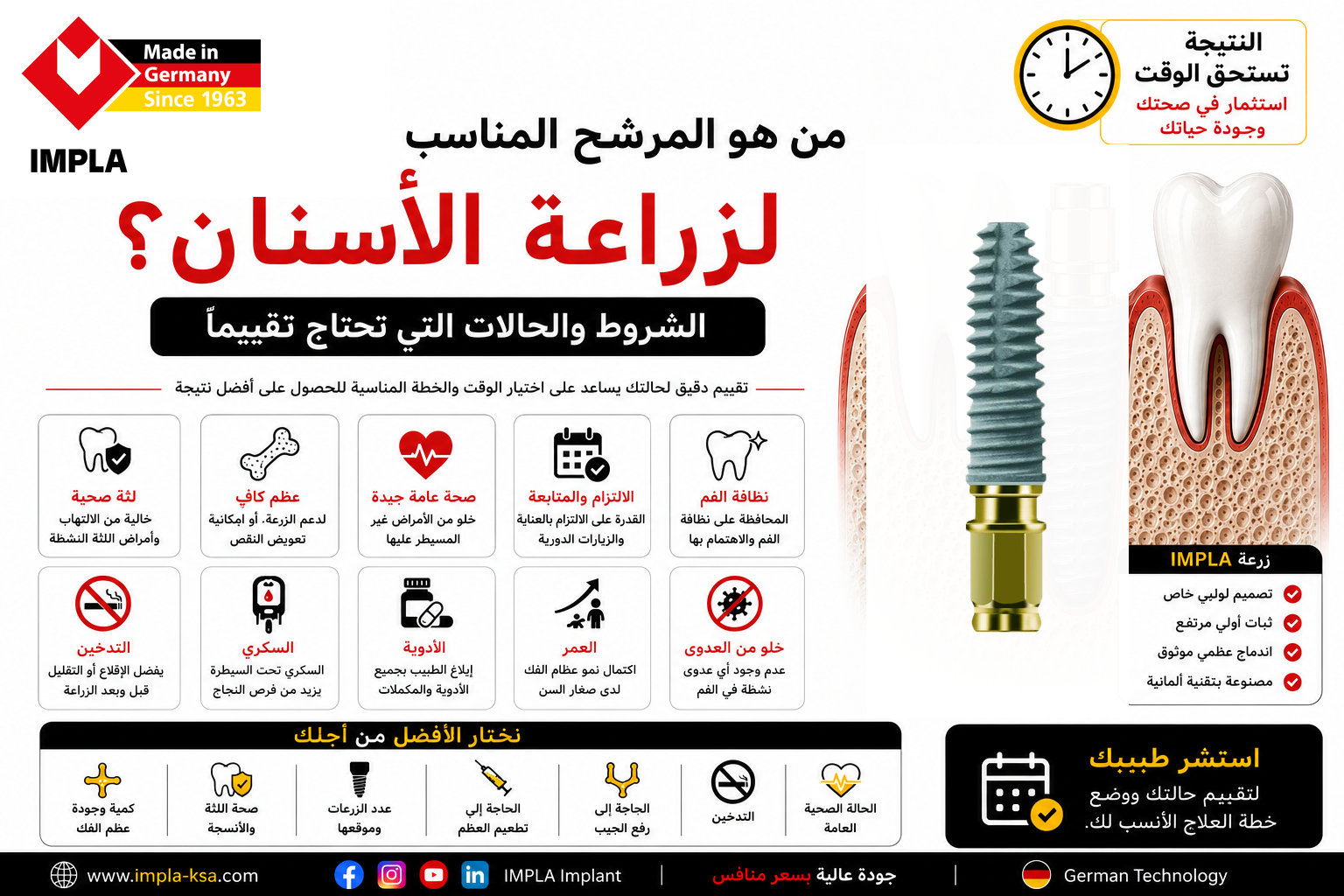 شروط زراعة الأسنان ومن هو المرشح المناسب للزراعة مع توضيح أهم عوامل صحة اللثة والعظم والحالة الصحية.