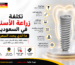تكلفة زراعة الأسنان في السعودية والعوامل التي تحدد السعر مثل نوع الزرعة وحالة العظم والتاج والفحوصات.