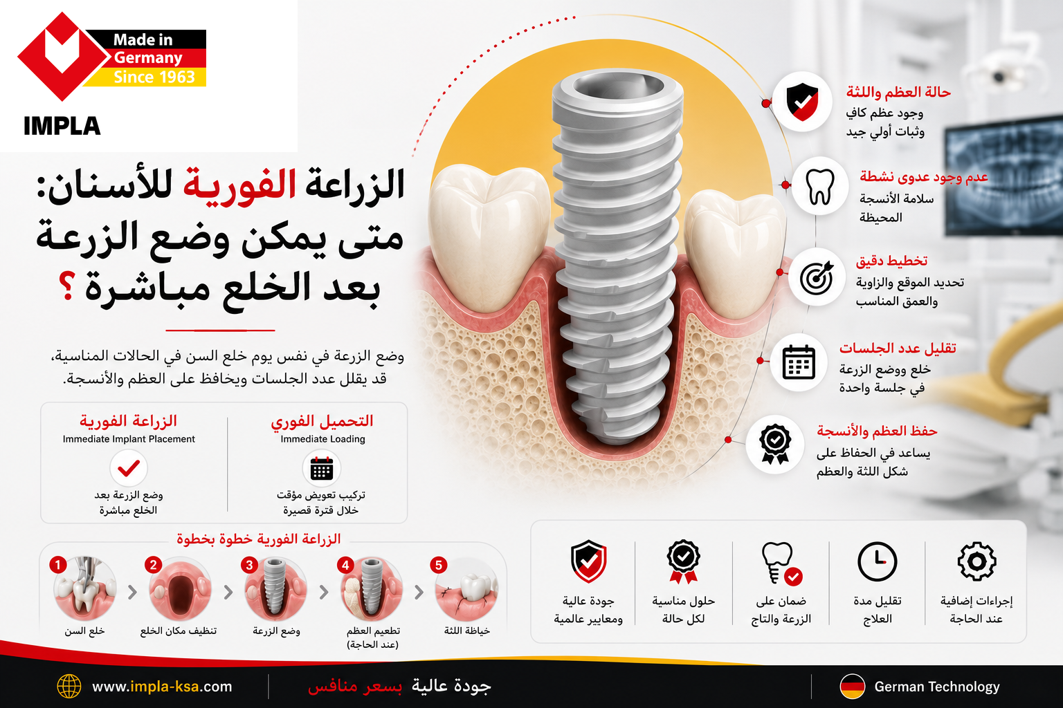 زراعة الأسنان الفورية ووضع زرعة الأسنان مباشرة بعد خلع السن في الحالات المناسبة.
